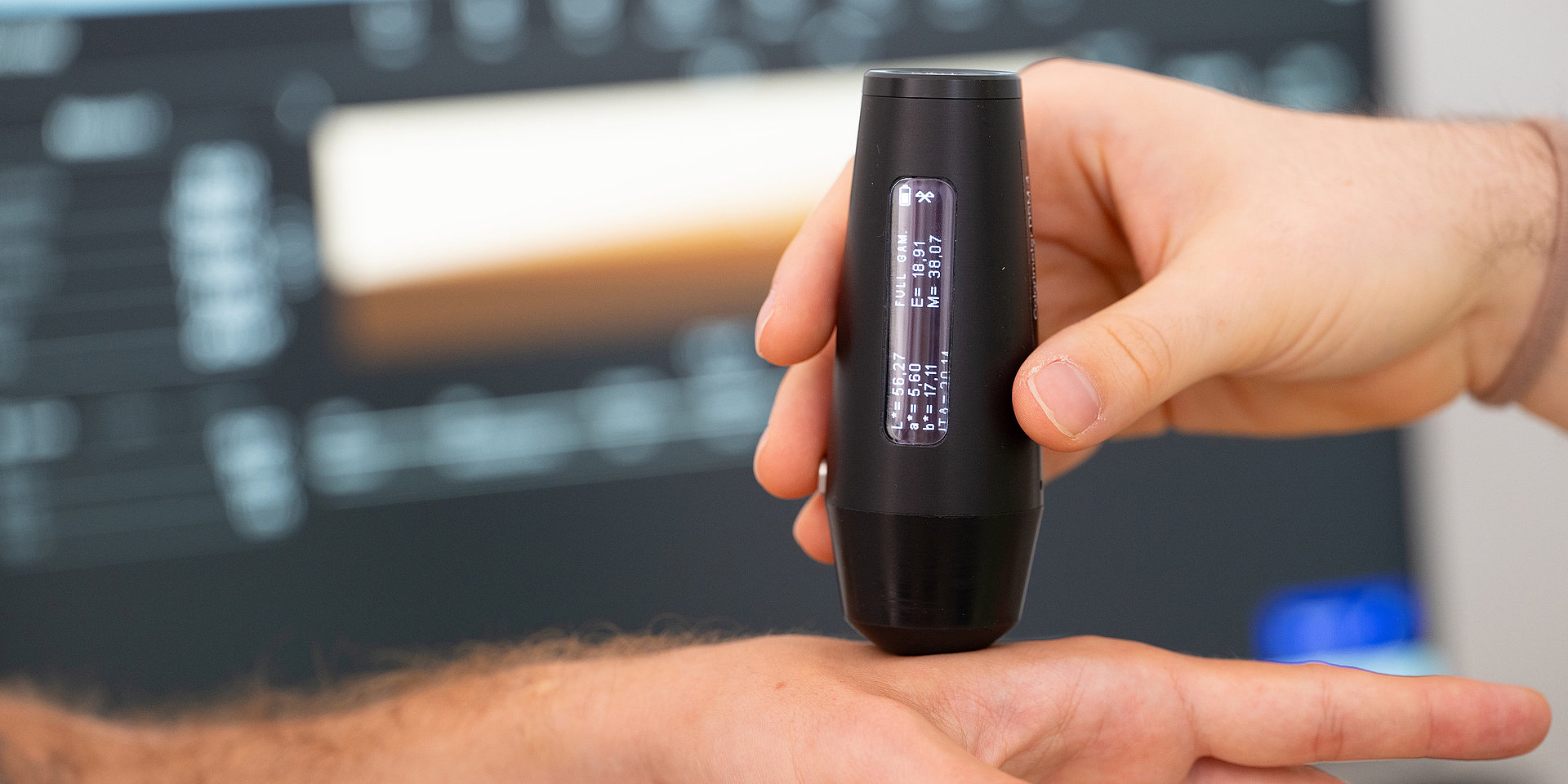 Colorimeter pressed on the arm to measure skin tone before imaging.